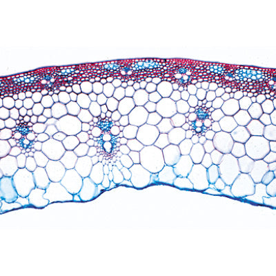 Angiospermae IV. Stems - English Slides