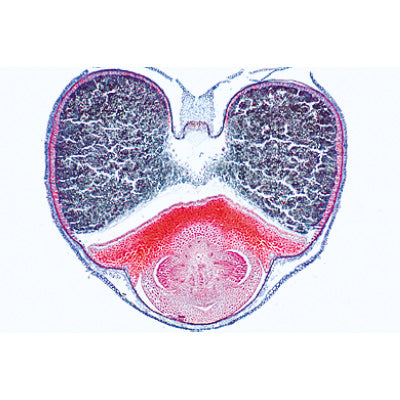 Angiospermae VII. Fruits and Seeds - English Slides
