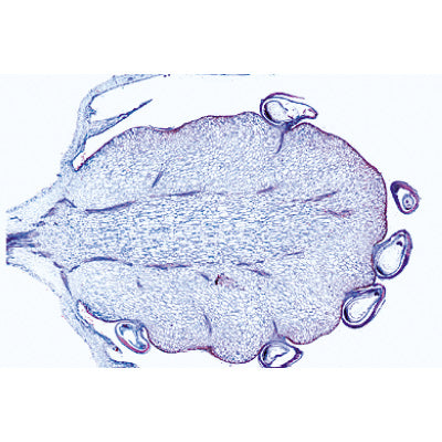 Angiospermae VII. Fruits and Seeds - English Slides