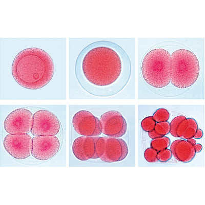 Set of Genetic Slides - English Slides
