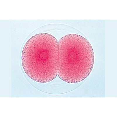 Sea urchin embryology (Psammechinus miliaris) - English Slides