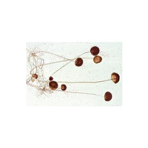 School Set A (Italian) – 25 biology slides on Zoology, Botany, and Histology: Amoeba, Hydra, Earthworm, Daphnia, Fly, Bee, Human tissues, Bacteria, Algae, Fungi, Moss, and plant sections of root, stem, leaf, flower, and ovary.
