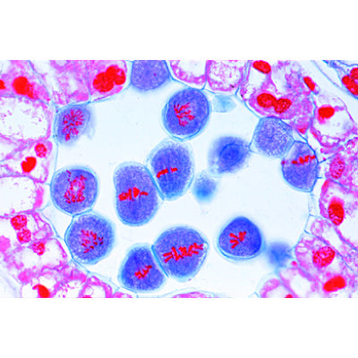 Mitosis and Meiosis Set II - Spanish