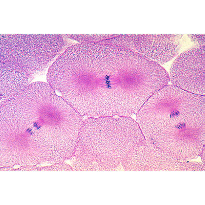 Mitosis and Meiosis Set II - Spanish
