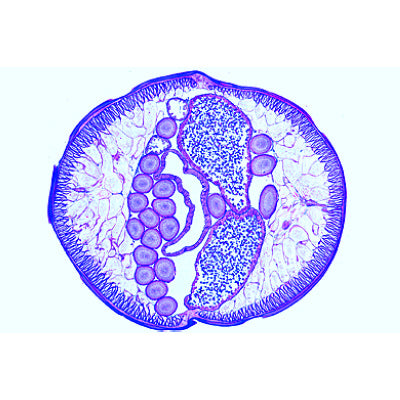The Ascaris megalocephala Embryology - German