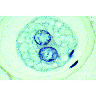 The Ascaris megalocephala Embryology - German
