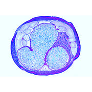 The Ascaris megalocephala Embryology - French
