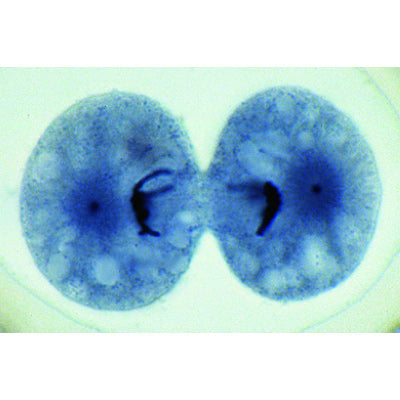 The Ascaris megalocephala Embryology - French
