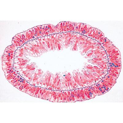 Series II. Metabolism - Spanish