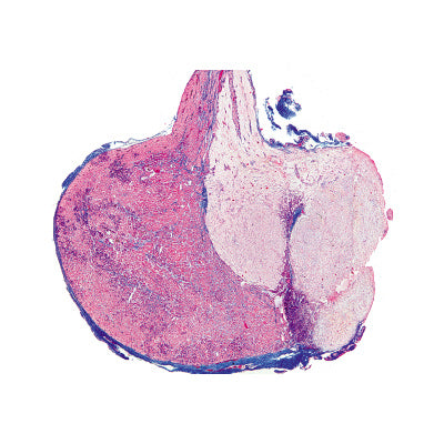 Series IV. Hormone Organs and Hormonal Function - Spanish