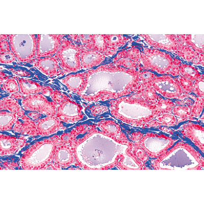 Normal Human Histology, Large Set, Part I. - Spanish