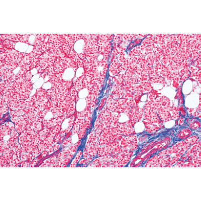 Normal Human Histology, Large Set, Part II. - Spanish