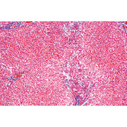 Human Pathology - Portuguese Slides