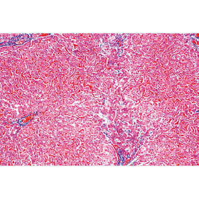 Human Pathology - Portuguese Slides