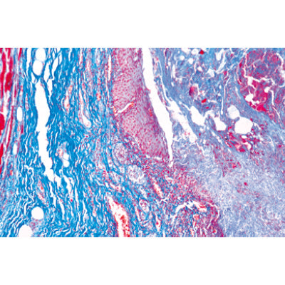 Human Pathology - Spanish