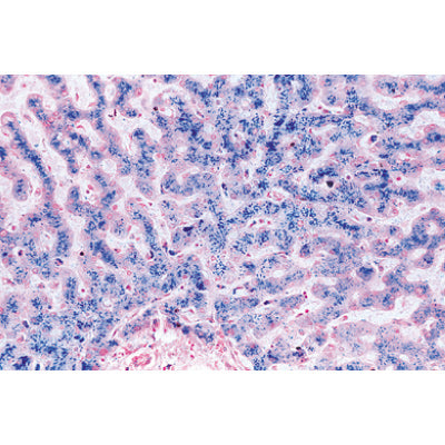 Human Pathology - German Slides