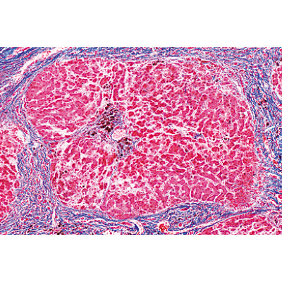 Human Pathology - German Slides