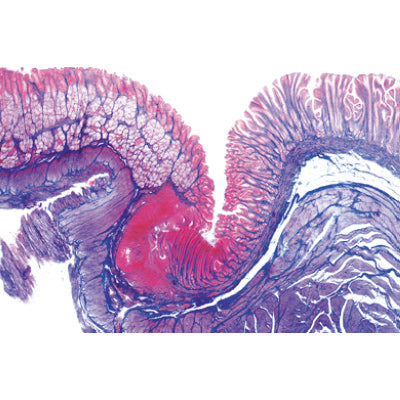 Digestive System - French