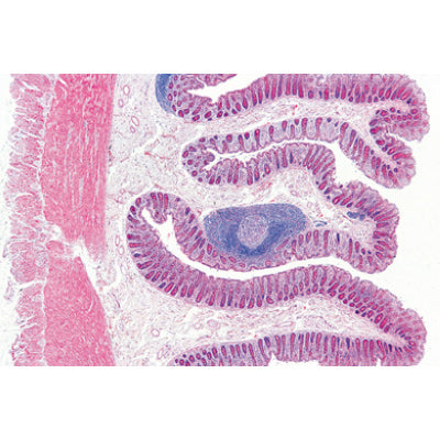 Digestive System - Spanish