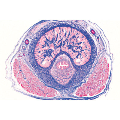 Urinary System - Spanish
