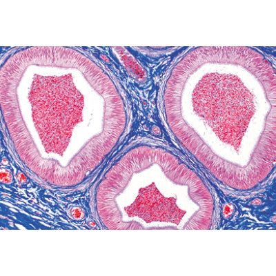 Genital System - Portuguese Slides