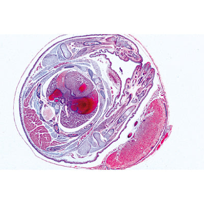 Genital System - Portuguese Slides