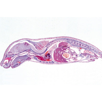 Genital System - Spanish