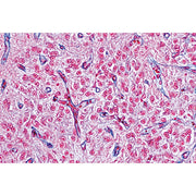 Endocrine System - Portuguese Slides