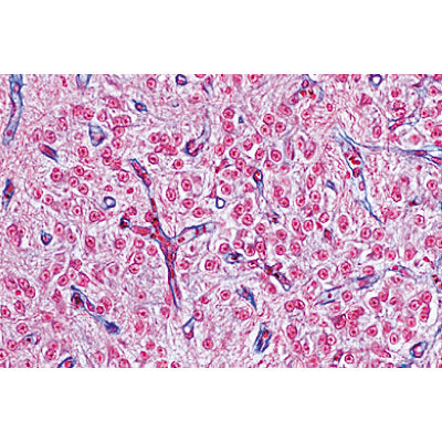 Endocrine System - Portuguese Slides