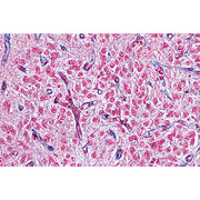 Endocrine System - German Slides