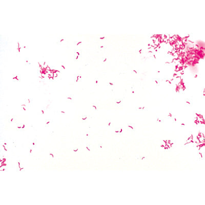 Pathogenic Bacteria - French