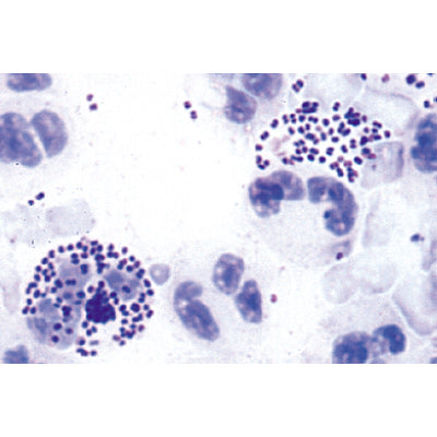 Pathogenic Bacteria - Portuguese