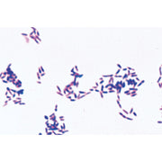 Pathogenic Bacteria - Spanish