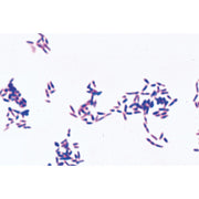Pathogenic Bacteria - German Slides
