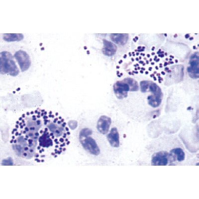 Pathogenic Bacteria - German Slides