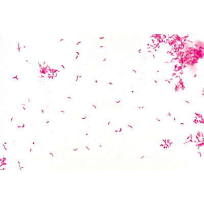 Pathogenic Bacteria - German Slides