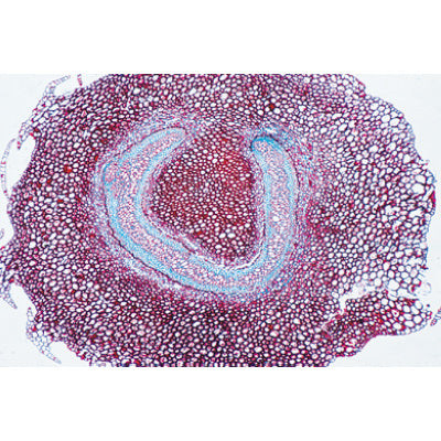 Arrangement and Types of Vascular Bundles - French