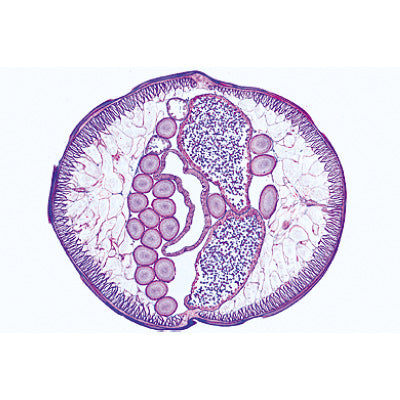 General Parasitology, Short Set - Spanish