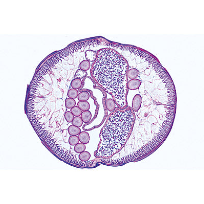 General Parasitology, Short Set - German Slides