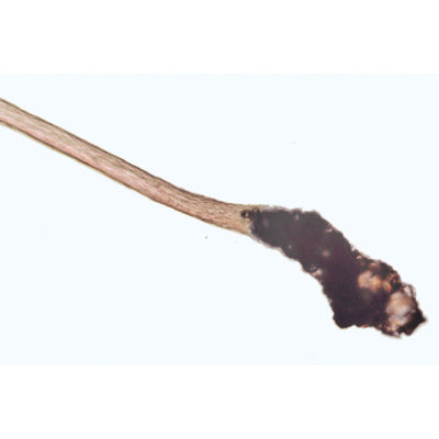 Human Scalp and Hair - French