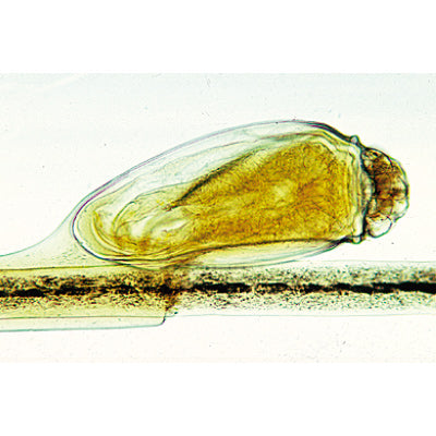 Human Scalp and Hair - German Slides