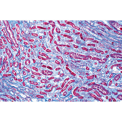 Human Pathology - English Slides