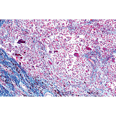 Human Pathology - English Slides