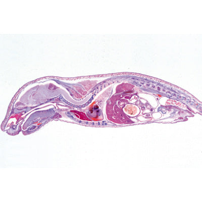Genital System - English Slides