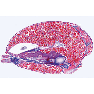 Invertebrata, Supplementary Set - English Slides