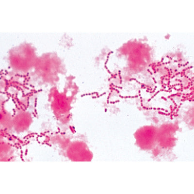 Pathogenic Bacteria - English Slides