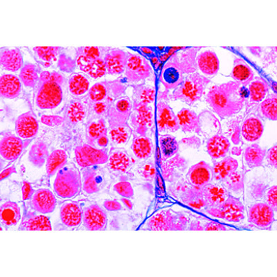 Mitosis and Meiosis Set I