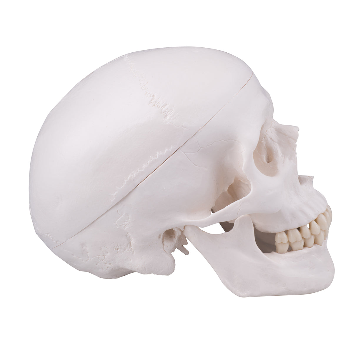 Skull with drill hole
