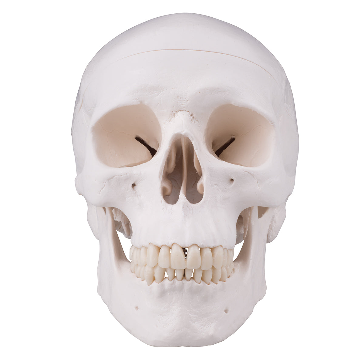 Skull with drill hole