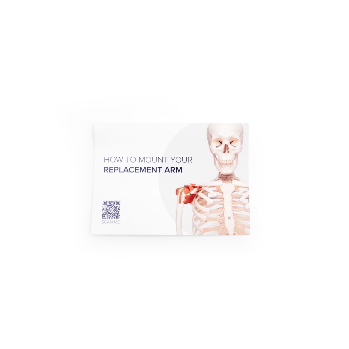 A13:Arm right capula, collarbone